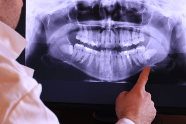 Best Emergency Gum Pain Relief  in Lauderdale Lakes, WI
