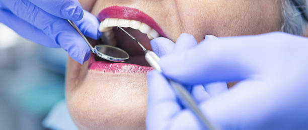 Best Chipped Tooth Repair Near Me  in Lauderdale Lakes, WI