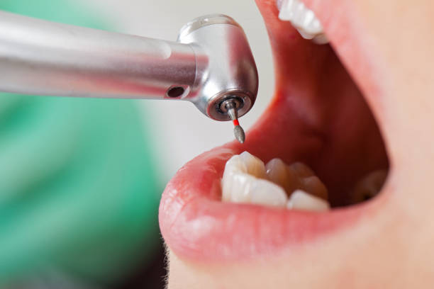 Best Cracked Tooth Emergency Dentist  in Lauderdale Lakes, WI